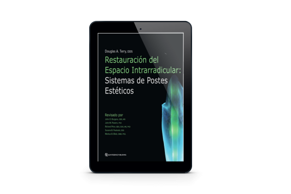 Restauración del Espacio Intrarradicular Sistemas de Postes Estéticos | Douglas A. Terry