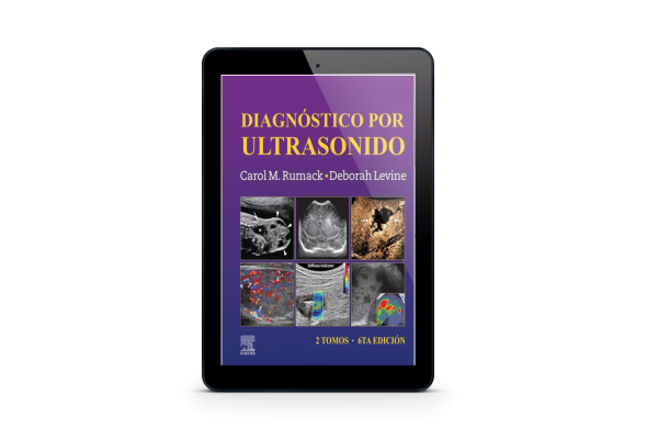 Diagnóstico por Ultrasonido | Carol M. Rumack
