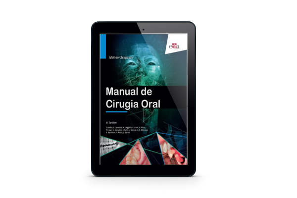 Manual de Cirugia Oral / Matteo Chiapasco