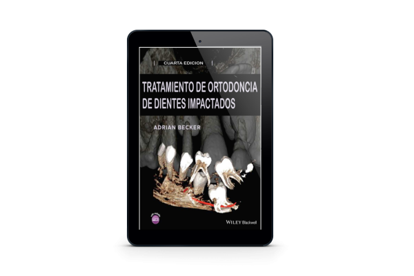 Tratamiento de ortodoncia de dientes impactados / Adrian Becker